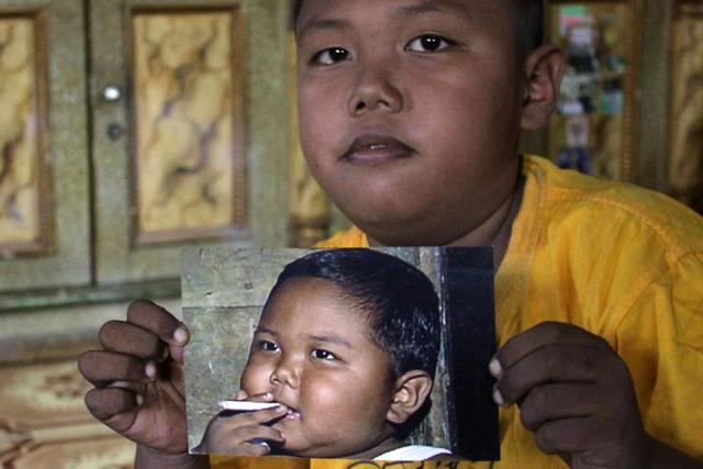 This Toddler Smoked 40 Cigarettes A Day - See What He Looks Now