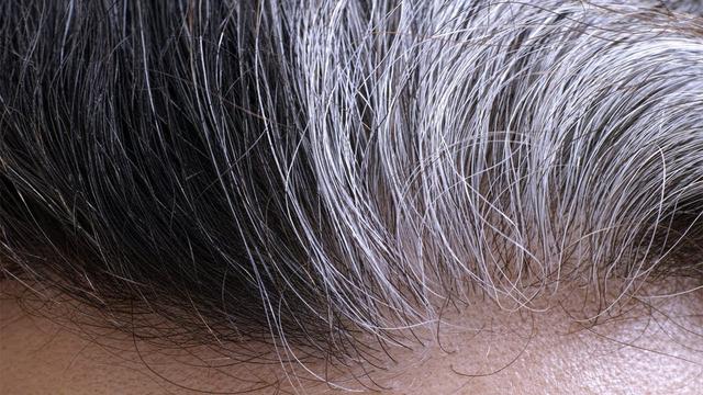 Coconut Oil And Lemon Mixture It Turns Gray Hair Back To Its