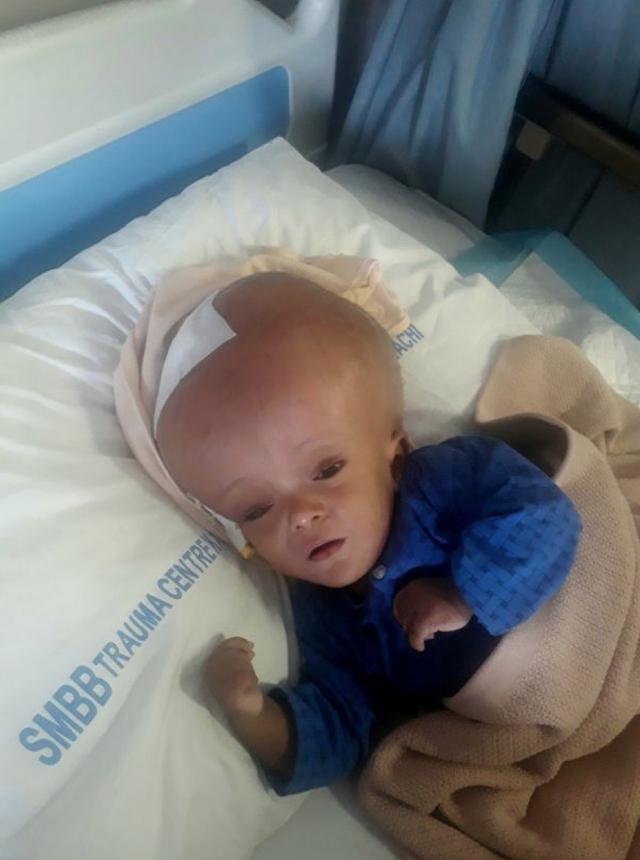 SHOCKING! This Baby Was Born With An “Alien Head” & His Parents Are