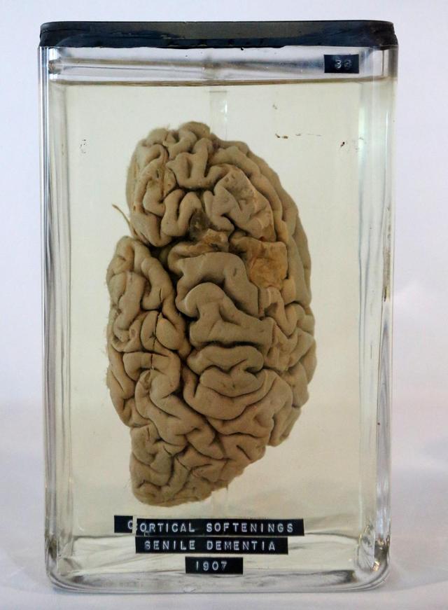 Brains Of Young People With Severe >> Brains Of Young People With Severe Behavioural Problems Are Wired Brains Of Young People With Severe >> Brains Of Young People With Severe Behavioural Problems Are Wired