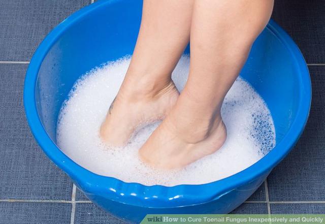 How to Cure Toenail Fungus Inexpensively and Quickly