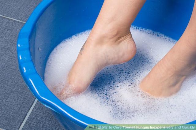 How to Cure Toenail Fungus Inexpensively and Quickly
