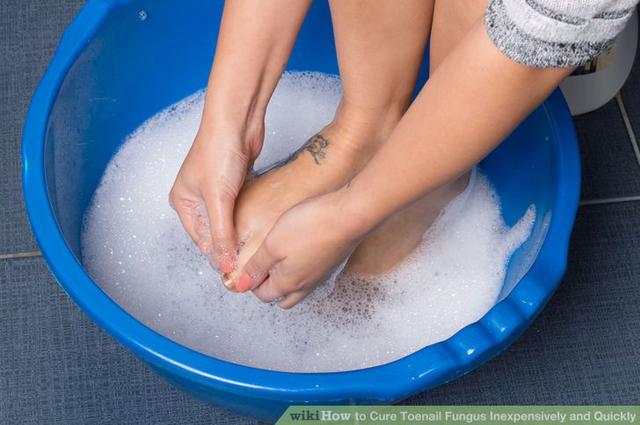 How to Cure Toenail Fungus Inexpensively and Quickly