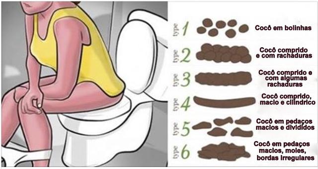 bolas amarelas e cilíndricas nas fezes