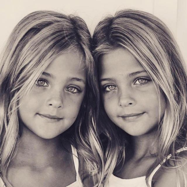 Identical Twins Were Born In 2010 Now, They’re Dubbed
