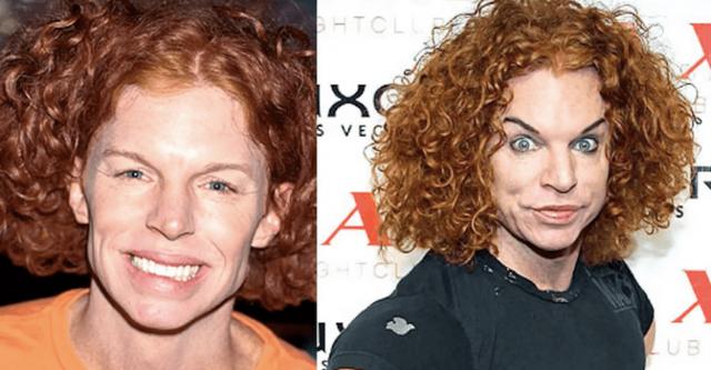 Before And After Photos Of The Craziest Celebrity Plastic Surgery Disasters