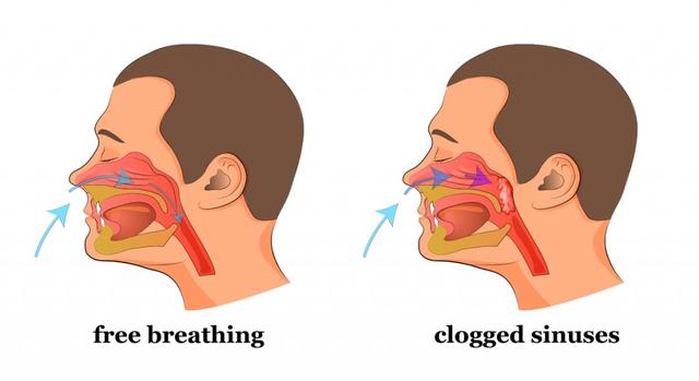 Do You Have A Stuffed Nose Or Clogged Sinuses This Simple Trick Will Clear It In A Few Seconds 国际 蛋蛋赞