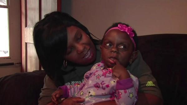 Mom Posts A Picture Of Her Baby With Rare Disorder On Facebook, Becomes Victim Of Cyberbullying
