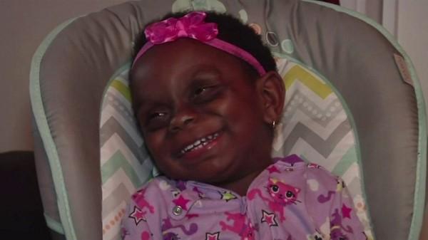 Mom Posts A Picture Of Her Baby With Rare Disorder On Facebook, Becomes Victim Of Cyberbullying