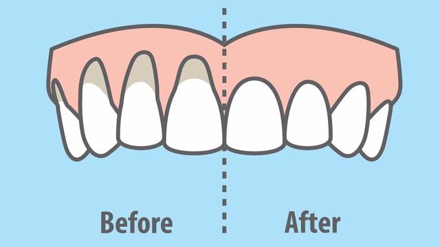 Dentists Explain 7 Habits That Ruin Your Teeth And Gums And How To Fix It 国际 蛋蛋赞