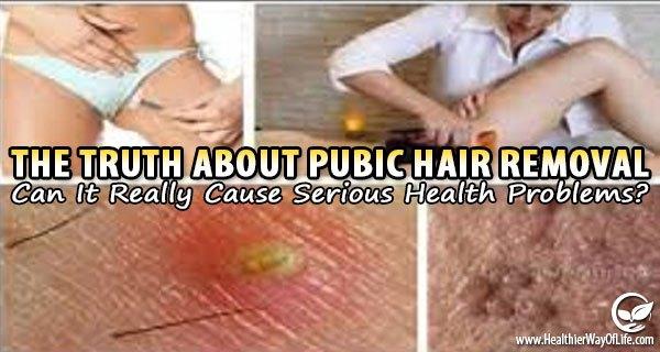 The Truth About Pubic Hair Removal Can It Really Cause Serious