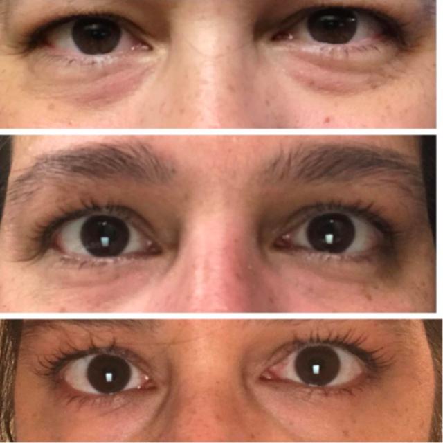 best amazon eye cream